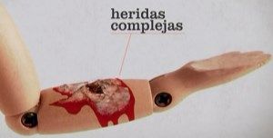 Curso Actualización en el manejo de heridas complejas