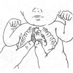 Curso de Formación en RCP Pediátrica