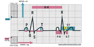 Electrocardiografía Básica para Enfermería en el ámbito de Urgencias.