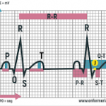 Electrocardiografía Básica para Enfermería en el ámbito de Urgencias.