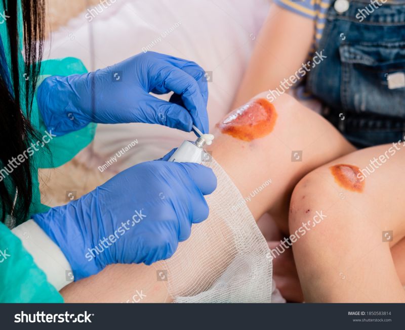Curso Manejo Avanzado de Heridas Complejas Ed.2