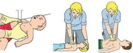 CURSO REANIMACIÓN CARDIOPULMONAR AVANZADA PEDIÁTRICA ED. 1