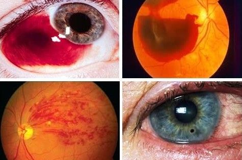 CURSO DE URGENCIAS OFTALMOLÓGICAS ED.1