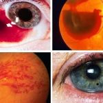 CURSO DE URGENCIAS OFTALMOLÓGICAS ED.1